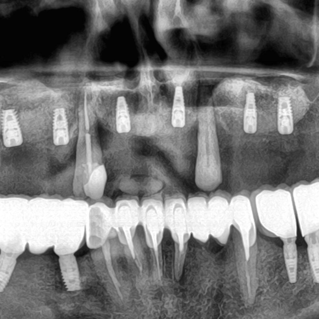 Metamorfoza pacjentki